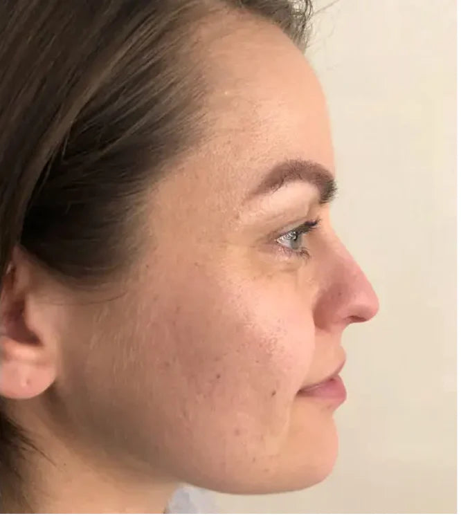 Truly radiant skin - After